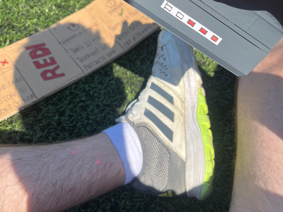 Prototype to show the lasers spreading out if the REDI device is held too far away from the injury