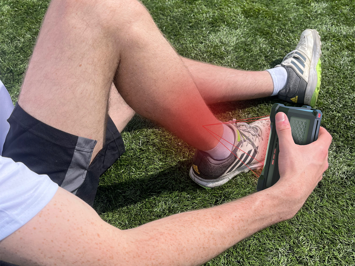 In context render of the REDI device being used to treat a lower extremity injury